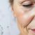 Objawy skórne menopauzy: Jak je rozpoznać i leczyć?